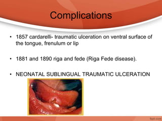Complications
• 1857 cardarelli- traumatic ulceration on ventral surface of
the tongue, frenulum or lip
• 1881 and 1890 riga and fede (Riga Fede disease).
• NEONATAL SUBLINGUAL TRAUMATIC ULCERATION
 