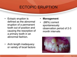 ECTOPIC ERUPTION
• Ectopic eruption is
defined as the abnormal
eruption of a permanent
tooth out of position and
causing the resorption of
a primary tooth in an
abnormal fashion.
• Arch length inadequacy
or variety of local factors
• Management
• (66%) correct
spontaneously
observation period of 2-3
month intervals
 