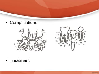 • Complications
• Treatment
 
