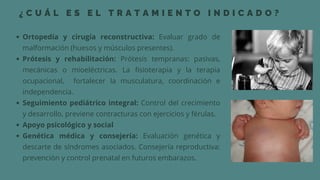 Focomelia Rx CASO CLINICO DE HISTOLOGIA FOCOMELIA EN RECIEN NACIDOS | PDF
