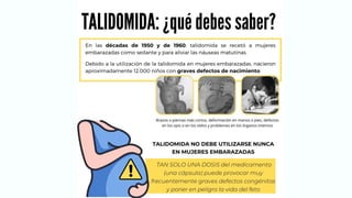 Focomelia Rx CASO CLINICO DE HISTOLOGIA FOCOMELIA EN RECIEN NACIDOS | PDF
