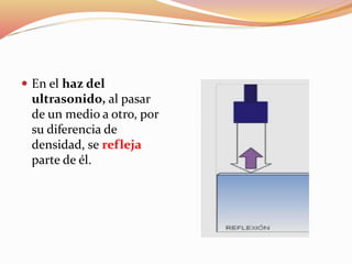  En el haz del
ultrasonido, al pasar
de un medio a otro, por
su diferencia de
densidad, se refleja
parte de él.
 
