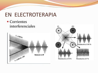 EN ELECTROTERAPIA
 Corrientes
interferenciales
 