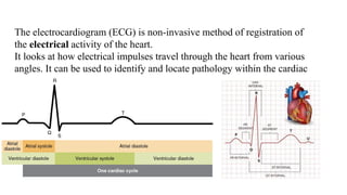 Comprehensive Overview of Cardiac Cycle and Electrocardiogram ...