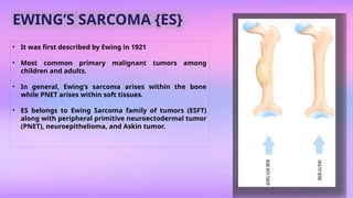 Pnet Sarcoma ROUND CELL LESION OF ORAL CAVITY .pptx
