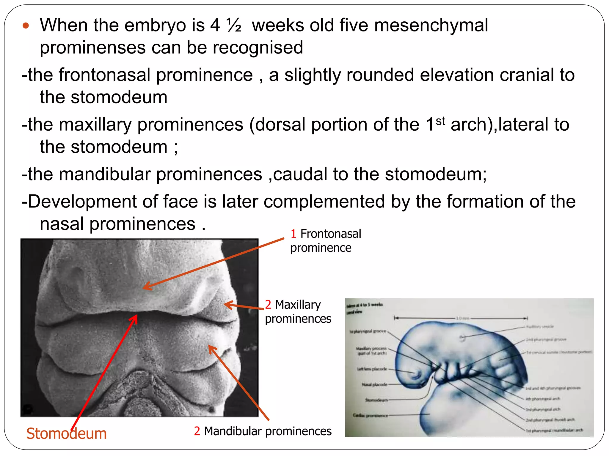  When the embryo is 4 ½ weeks old five mesenchymal
prominenses can be recognised
-the frontonasal prominence , a slightly rounded elevation cranial to
the stomodeum
-the maxillary prominences (dorsal portion of the 1st arch),lateral to
the stomodeum ;
-the mandibular prominences ,caudal to the stomodeum;
-Development of face is later complemented by the formation of the
nasal prominences .
Stomodeum
1 Frontonasal
prominence
2 Maxillary
prominences
2 Mandibular prominences
 