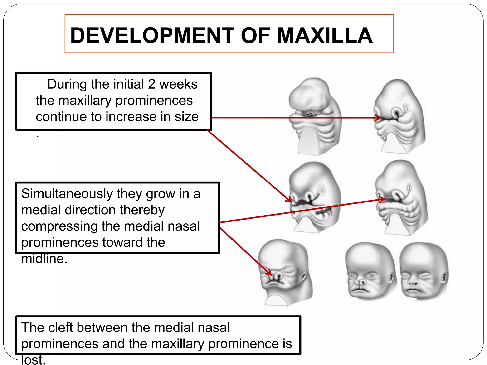 DEVELOPMENT OF MAXILLA
During the initial 2 weeks
the maxillary prominences
continue to increase in size
.
The cleft between the medial nasal
prominences and the maxillary prominence is
lost.
Simultaneously they grow in a
medial direction thereby
compressing the medial nasal
prominences toward the
midline.
 