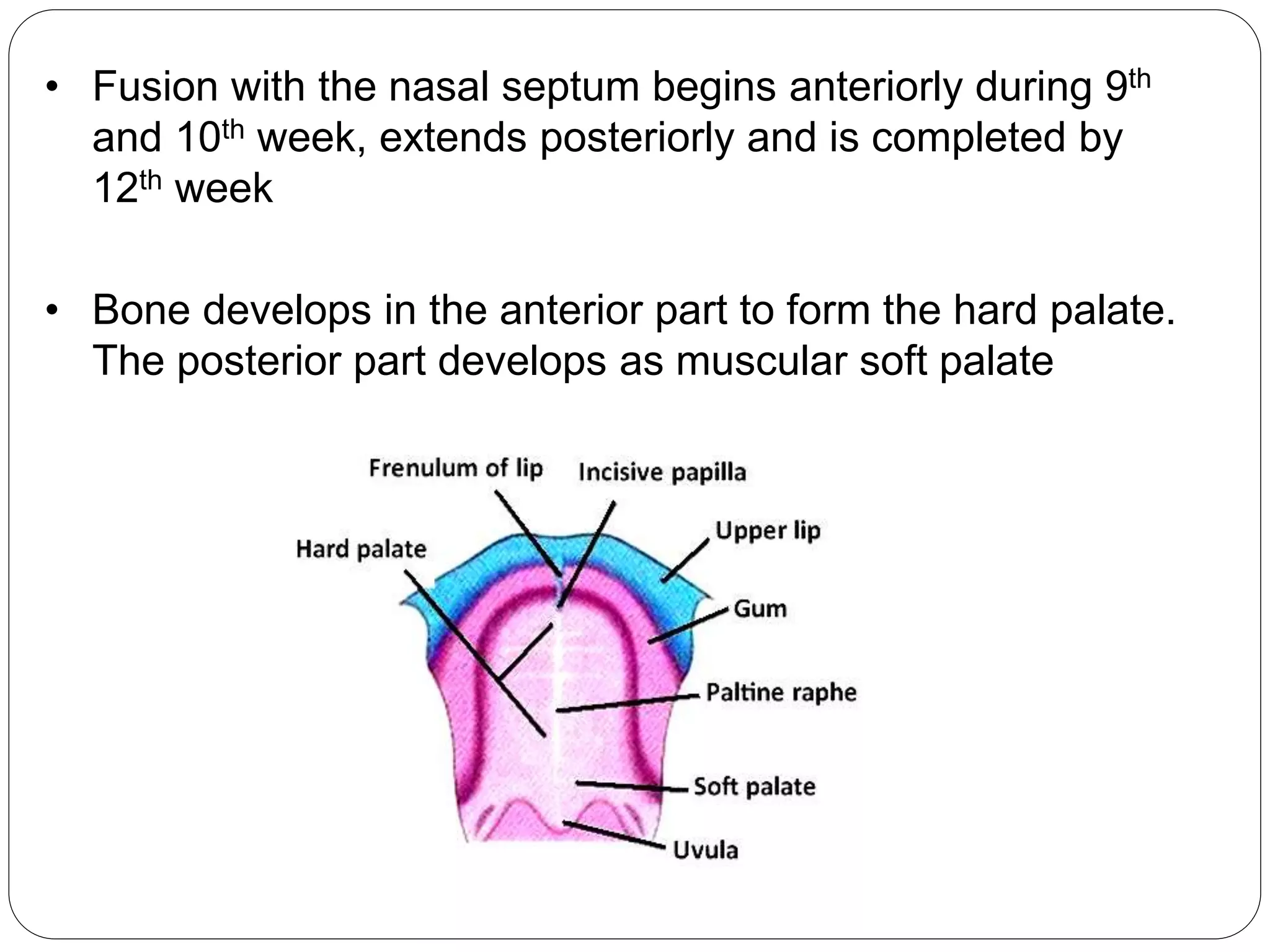 • Fusion with the nasal septum begins anteriorly during 9th
and 10th week, extends posteriorly and is completed by
12th week
• Bone develops in the anterior part to form the hard palate.
The posterior part develops as muscular soft palate
 