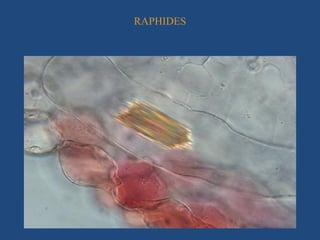 RAPHIDES
 