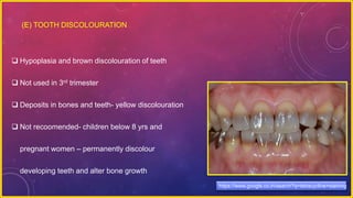 https://www.google.co.in/search?q=tetracycline+staining
 Hypoplasia and brown discolouration of teeth
 Not used in 3rd trimester
 Deposits in bones and teeth- yellow discolouration
 Not recoomended- children below 8 yrs and
pregnant women – permanently discolour
developing teeth and alter bone growth
(E) TOOTH DISCOLOURATION
 