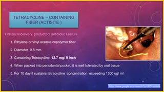 91
TETRACYCLINE – CONTAINING
FIBER (ACTISITE )
First local delivery product for antibiotic Feature
1. Ethylene or vinyl acetate copolymer fiber
2. Diameter 0.5 mm
3. Containing Tetracycline 12.7 mg/ 9 inch
4. When packed into periodontal pocket, it is well tolerated by oral tissue
5. For 10 day it sustains tetracycline concentration exceeding 1300 ug/ ml
https://www.google.co.in/search?q=LDD+actisite
 