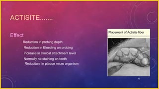 92
ACTISITE.......
Effect
Reduction in probing depth
Reduction in Bleeding on probing
Increase in clinical attachment level
Normally no staining on teeth
Reduction in plaque micro organism
 