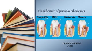Classification of periodontal diseases
DR. BENITAMARIAREGI
1ST MDS
 