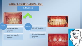 classification of periodontal diseases | PPTX