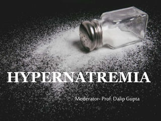 HYPERNATREMIA
Moderator- Prof. DalipGupta
 