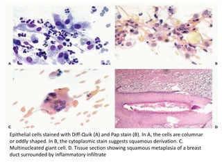 cytology of the breast | PPTX