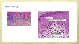 Histopathology
 
