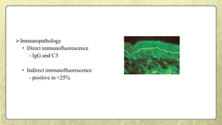 Immunopathology
• Direct immunofluorescence
- IgG and C3
• Indirect immunofluorescence
- positive in <25%
 
