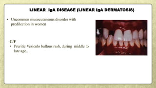 LINEAR IgA DISEASE (LINEAR IgA DERMATOSIS)
• Uncommon mucocutaneous disorder with
predilection in women
C/F
• Pruritic Vesiculo bullous rash, during middle to
late age..
 