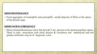HISTOPATHOLOGY
 Focal aggregates of neutrophils and eosinophils amidst deposits of fibrin at the apices
of the dermal pegs.
IMMUNOFLUORESENCE
 Direct immunofluoresence show that IgA &C3 are present at the dermal papillary apices.
There is clear association with celiac disease & circulatory anti endomysial and anti
gliaden antibodies may be of diagnostic value.
 