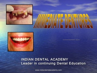 INDIAN DENTAL ACADEMYINDIAN DENTAL ACADEMY
Leader in continuing Dental EducationLeader in continuing Dental Education
www.indiandentalacademy.comwww.indiandentalacademy.com
 