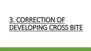 3. CORRECTION OF
DEVELOPING CROSS BITE
 