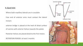 8. Quad helix
Where both maxillary laterals are in crossbite
Free end of anterior arms must contact the lateral
incisors
anterior bridge is placed at the level of distal surface
of canines with anterior helices towards the palate
Posterior helices are placed distal to the first molars
RETENTION PERIOD: at least 3 months
 