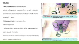 Activation
1. extraoralactivation:openingthe helix:
anterior helix:posteriorexpansion(5mm on each molar side)
posteriorhelix:lateral movementof anterior arms anterior
expansion(1.5mm)
2. intraoralactivation:three prong plier:
anteriorexpansion
: posteriorbendis placedon palatal bridge by keepingsingle
prong towards the midline
Posteriorexpansion:anterior bendplace on anterior bridge by
keepingsingle prong anteriorly
 