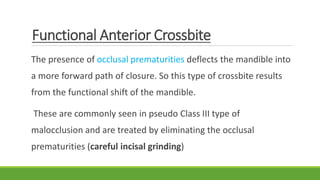Functional Anterior Crossbite
The presence of occlusal prematurities deflects the mandible into
a more forward path of closure. So this type of crossbite results
from the functional shift of the mandible.
These are commonly seen in pseudo Class III type of
malocclusion and are treated by eliminating the occlusal
prematurities (careful incisal grinding)
 