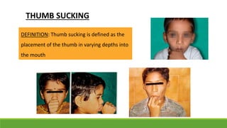 THUMB SUCKING
DEFINITION: Thumb sucking is defined as the
placement of the thumb in varying depths into
the mouth
 