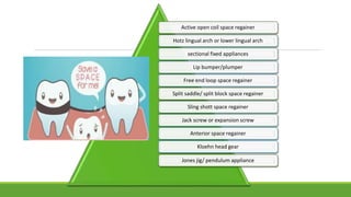 Active open coil space regainer
Hotz lingual arch or lower lingual arch
sectional fixed appliances
Lip bumper/plumper
Free end loop space regainer
Split saddle/ split block space regainer
Sling shott space regainer
Jack screw or expansion screw
Anterior space regainer
Kloehn head gear
Jones jig/ pendulum appliance
 