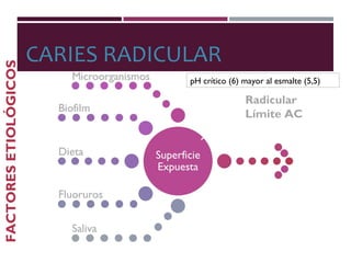 CARIES RADICULAR
FACTORESETIOLÓGICOS
CR
pH crítico (6) mayor al esmalte (5,5)
Radicular
Límite AC
 
