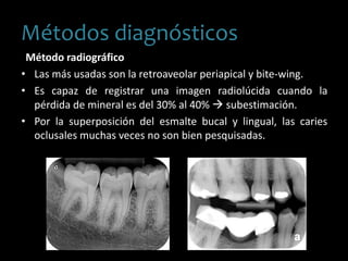 Método radiográfico
• Las más usadas son la retroaveolar periapical y bite-wing.
• Es capaz de registrar una imagen radiolúcida cuando la
pérdida de mineral es del 30% al 40%  subestimación.
• Por la superposición del esmalte bucal y lingual, las caries
oclusales muchas veces no son bien pesquisadas.
Métodos diagnósticos
 