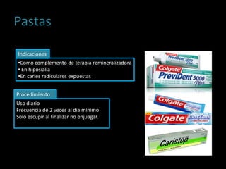 Pastas
•Como complemento de terapia remineralizadora
• En hiposialia
•En caries radiculares expuestas
Uso diario
Frecuencia de 2 veces al día mínimo
Solo escupir al finalizar no enjuagar.
Indicaciones
Procedimiento
 