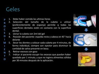 Geles
1. Debe haber comido las ultimas horas
2. Selección del tamaño de la cubeta a utilizar
(preferentemente de esponja) permite q todas las
superficies dentales estén en contacto con la superficie
dental.
3. Llenar la cubeta con 2ml del gel
4. Posición del paciente: espalda recta y cabeza en 45° hacia
delante
5. Secar los dientes y colocar cada cubeta por 4 minutos, de
forma individual, siempre con eyector para disminuir la
cantidad de saliva presente en boca.
6. Retirar excesos con gasa
7. Indicar al paciente escupir los excesos que puedan haber
quedado por 1 minuto, y que no ingiera alimentos sólidos
por 30 minutos después de la aplicación.
P
R
O
C
E
D
I
M
I
E
N
T
O
 
