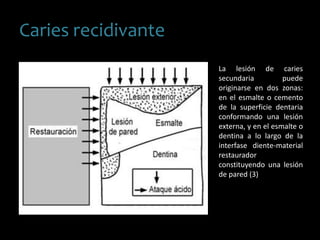 Caries recidivante
La lesión de caries
secundaria puede
originarse en dos zonas:
en el esmalte o cemento
de la superficie dentaria
conformando una lesión
externa, y en el esmalte o
dentina a lo largo de la
interfase diente-material
restaurador
constituyendo una lesión
de pared (3)
 
