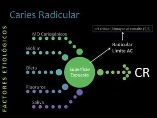 Caries Radicular
FACTORESETIOLÓGICOS
Superficie
Expuesta
MO Cariogénicos
Biofilm
Dieta
Fluoruros
Saliva
CR
pH crítico (6)mayor al esmalte (5,5)
Radicular
Límite AC
 