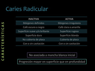 Caries Radicular
CARACTERÍSTICAS
INACTIVA ACTIVA
Márgenes definidos Márgenes irregulares
Café oscuro o negro Café clara o amarilla
Superficie suave y/o brillante Superficie rugosa
Superficie dura Superficie blanda
No cubierta de placa Cubierta de placa
Con o sin cavitación Con o sin cavitación
No asociada a mancha blanca inicial
Progresión mayor en superficie que en profundidad
 