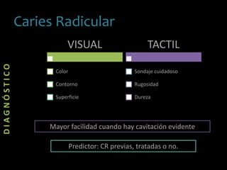 DIAGNÓSTICO
Caries Radicular
VISUAL
Color
Contorno
Superficie
TACTIL
Sondaje cuidadoso
Rugosidad
Dureza
Mayor facilidad cuando hay cavitación evidente
Predictor: CR previas, tratadas o no.
 