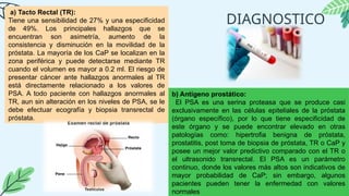 DIAGNOSTICO
a) Tacto Rectal (TR):
Tiene una sensibilidad de 27% y una especificidad
de 49%. Los principales hallazgos que se
encuentran son asimetría, aumento de la
consistencia y disminución en la movilidad de la
próstata. La mayoría de los CaP se localizan en la
zona periférica y puede detectarse mediante TR
cuando el volumen es mayor a 0.2 ml. El riesgo de
presentar cáncer ante hallazgos anormales al TR
está directamente relacionado a los valores de
PSA. A todo paciente con hallazgos anormales al
TR, aun sin alteración en los niveles de PSA, se le
debe efectuar ecografía y biopsia transrectal de
próstata.
b) Antígeno prostático:
El PSA es una serina proteasa que se produce casi
exclusivamente en las células epiteliales de la próstata
(órgano específico), por lo que tiene especificidad de
este órgano y se puede encontrar elevado en otras
patologías como: hipertrofia benigna de próstata,
prostatitis, post toma de biopsia de próstata, TR o CaP y
posee un mejor valor predictivo comparado con el TR o
el ultrasonido transrectal. El PSA es un parámetro
continuo, donde los valores más altos son indicativos de
mayor probabilidad de CaP; sin embargo, algunos
pacientes pueden tener la enfermedad con valores
normales
 