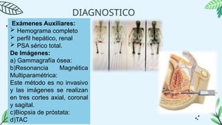DIAGNOSTICO
Exámenes Auxiliares:
 Hemograma completo
 perfil hepático, renal
 PSA sérico total.
De Imágenes:
a) Gammagrafía ósea:
b)Resonancia Magnética
Multiparamétrica:
Este método es no invasivo
y las imágenes se realizan
en tres cortes axial, coronal
y sagital.
c)Biopsia de próstata:
d)TAC
 