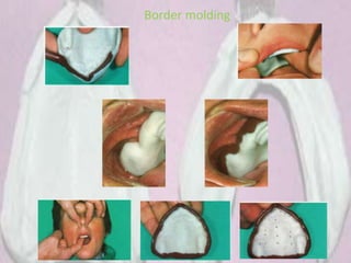 Border molding
 
