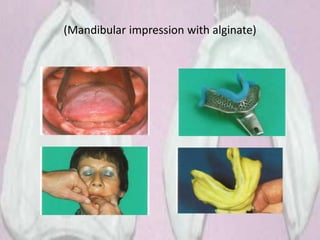 (Mandibular impression with alginate)
 