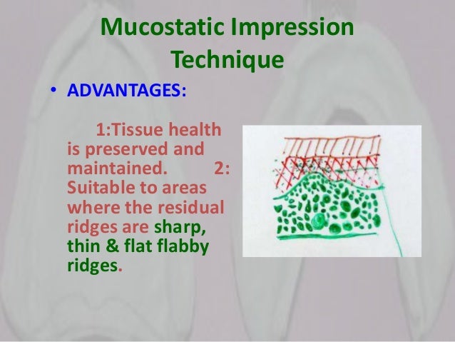 impression making-theories and techniques in complete denture