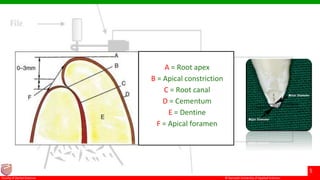 © Ramaiah University of Applied Sciences
5
Faculty of Dental Sciences
A = Root apex
B = Apical constriction
C = Root canal
D = Cementum
E = Dentine
F = Apical foramen
 