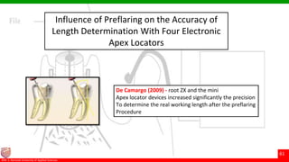 © Ramaiah University of Applied Sciences
61
Faculty of Dental Sciences©M. S. Ramaiah University of Applied Sciences
61
Influence of Preflaring on the Accuracy of
Length Determination With Four Electronic
Apex Locators
De Camargo (2009) - root ZX and the mini
Apex locator devices increased significantly the precision
To determine the real working length after the preflaring
Procedure
 