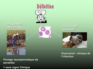 PALUDISME
  INFECTION                  PALUDISME
                             MALADIE




                            Expression clinique de
                            l’infection
Portage asymptomatique de
parasites
= sans signe Clinique
 