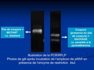 Pas de coupure =                                      Coupure
    MUTANT                                      (presence du site
  i.e. résistant                                   de coupure) =
                                                     SAUVAGE
                                                 i.e. sensible à la
                                                  pyriméthamine


                 Illustration de la PCR/RFLP
   Photos de gél après incubation de l’amplicon de pfdhfr en
           présence de l’enzyme de restriction AluI
 