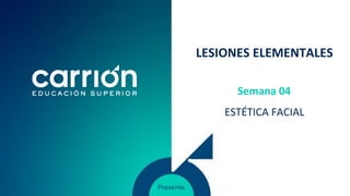 LESIONES ELEMENTALES
ESTÉTICA FACIAL
Semana 04
 