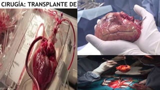 CIRUGÍA: TRANSPLANTE DE CORAZON
 